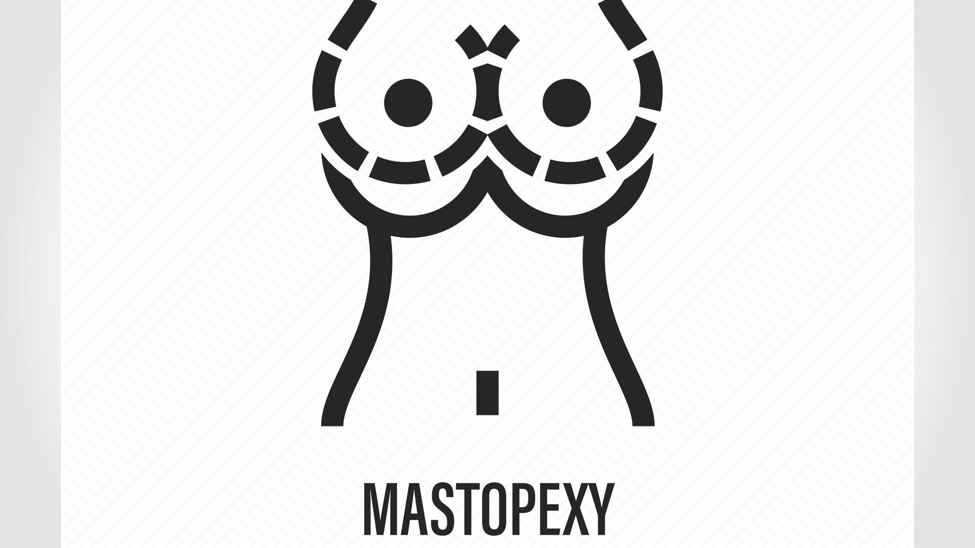 Mastopexia com Prótese