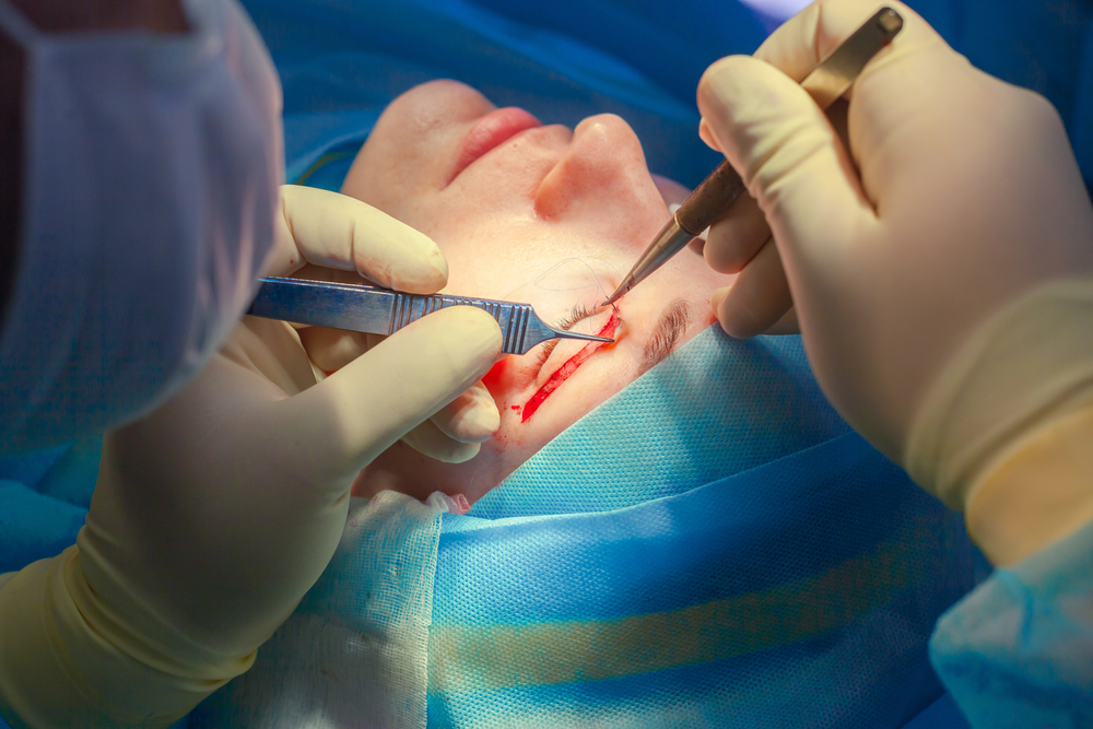 Médico realizando blefaroplastia em paciente